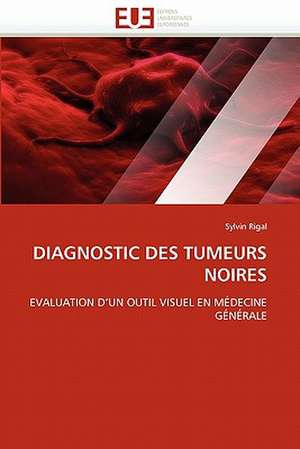 Diagnostic Des Tumeurs Noires: Image, Imaginaire, Societe de Sylvin Rigal