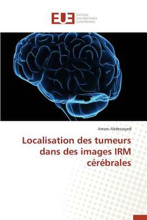 Localisation Des Tumeurs Dans Des Images Irm Cerebrales: Un Nouveau Protocole de Securite de Amani Abdessayed