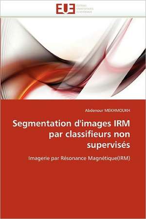 Segmentation d'images IRM par classifieurs non supervisés de Abdenour Mekhmoukh