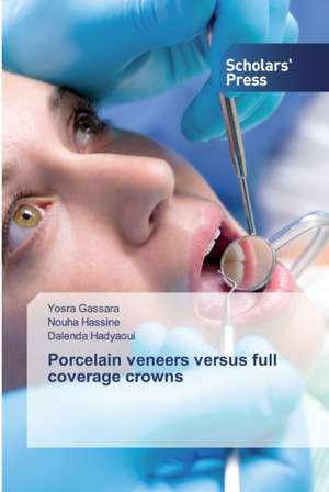 Porcelain veneers versus full coverage crowns de Yosra Gassara