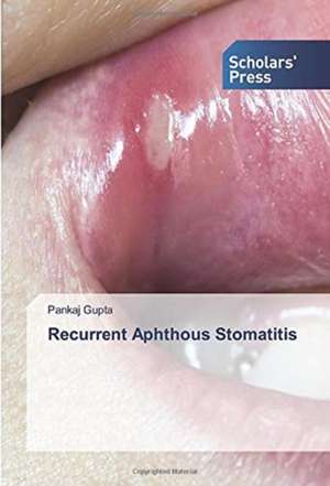 Recurrent Aphthous Stomatitis de Pankaj Gupta