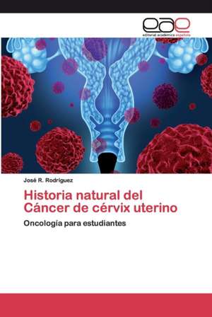 Historia natural del Cáncer de cérvix uterino de José R. Rodriguez