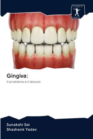 Gingiva: de Sunakshi Soi