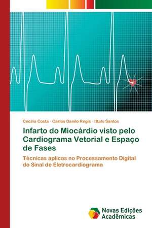 Infarto do Miocárdio visto pelo Cardiograma Vetorial e Espaço de Fases de Cecilia Costa