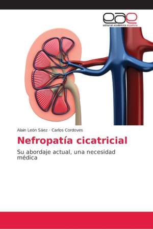 Nefropatía cicatricial de Alain León Sáez