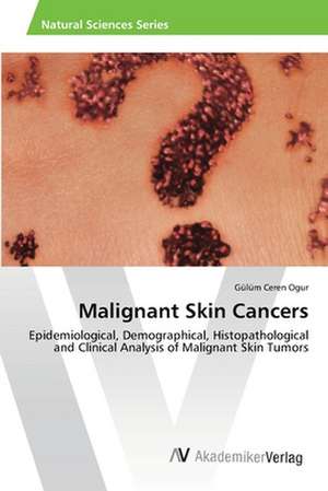 Malignant Skin Cancers de Gülüm Ceren Ogur