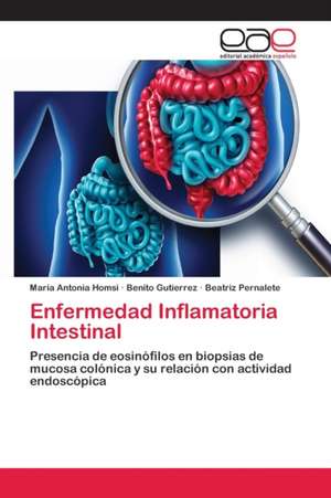 Enfermedad Inflamatoria Intestinal de Maria Antonia Homsi