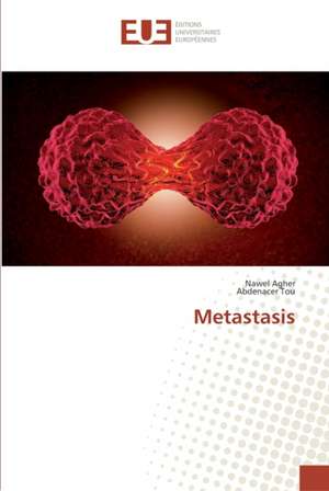 Metastasis de Nawel Agher