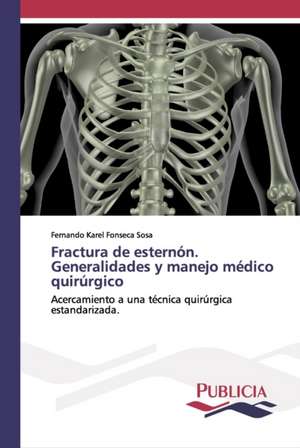 Fractura de esternón. Generalidades y manejo médico quirúrgico de Fernando Karel Fonseca Sosa