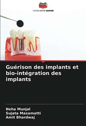 Guérison des implants et bio-intégration des implants de Neha Munjal