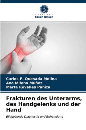 Frakturen des Unterarms, des Handgelenks und der Hand de Carlos F. Quesada Molina