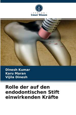 Rolle der auf den endodontischen Stift einwirkenden Kräfte de Dinesh Kumar