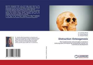 Distraction Osteogenesis de Vishakha Bhindi