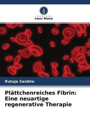 Plättchenreiches Fibrin: Eine neuartige regenerative Therapie de Rutuja Sankhe