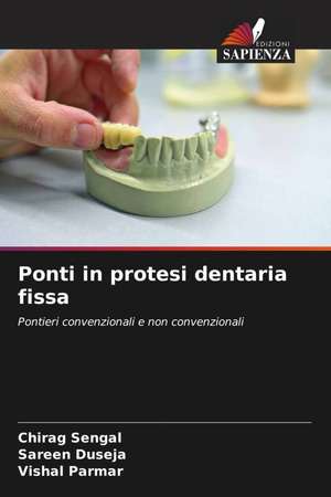 Ponti in protesi dentaria fissa de Chirag Sengal