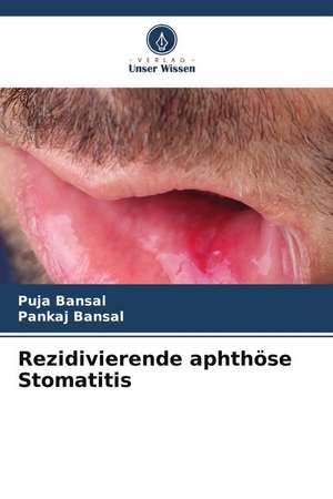 Rezidivierende aphthöse Stomatitis de Puja Bansal