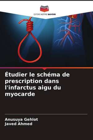 Étudier le schéma de prescription dans l'infarctus aigu du myocarde de Anusuya Gehlot