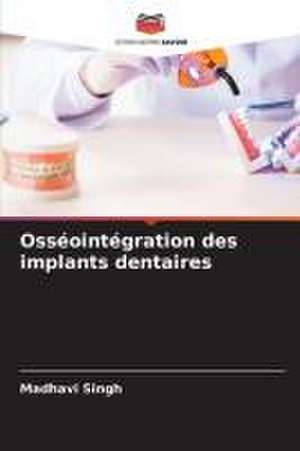 Osséointégration des implants dentaires de Madhavi Singh