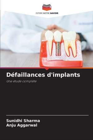 Défaillances d'implants de Sunidhi Sharma