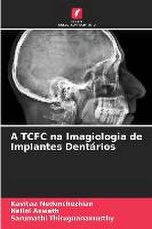 A TCFC na Imagiologia de Implantes Dentários de Kavitaa Nedunchezhian