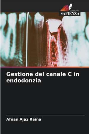 Gestione del canale C in endodonzia de Afnan Ajaz Raina