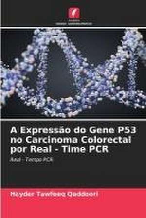 A Expressão do Gene P53 no Carcinoma Colorectal por Real - Time PCR de Hayder Tawfeeq Qaddoori