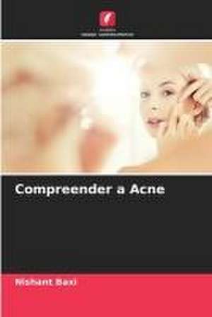 Compreender a Acne de Nishant Baxi