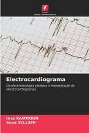 Electrocardiograma de Ines Kammoun