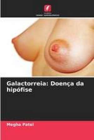 Galactorreia: Doença da hipófise de Megha Patel