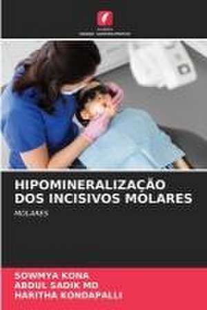 HIPOMINERALIZAÇÃO DOS INCISIVOS MOLARES de Sowmya Kona