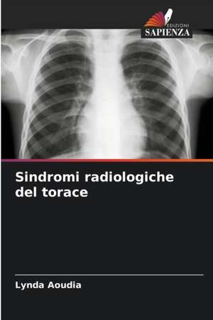 Sindromi radiologiche del torace de Lynda Aoudia