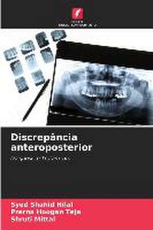 Discrepância anteroposterior de Syed Shahid Hilal