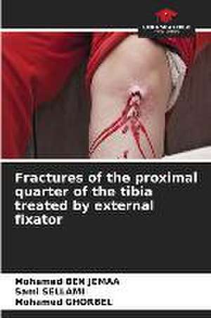 Fractures of the proximal quarter of the tibia treated by external fixator de Mohamed Ben Jemaa