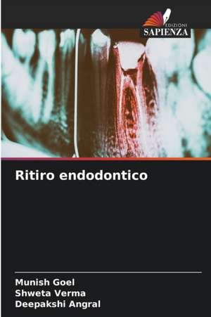 Ritiro endodontico de Munish Goel