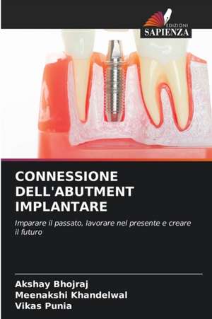 CONNESSIONE DELL'ABUTMENT IMPLANTARE de Akshay Bhojraj