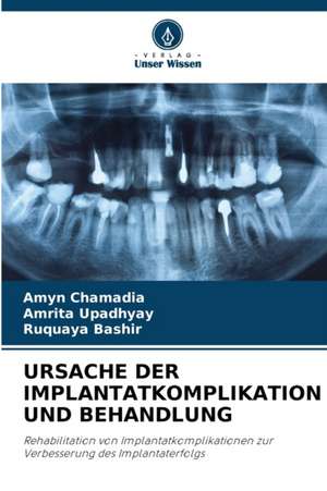 URSACHE DER IMPLANTATKOMPLIKATION UND BEHANDLUNG de Amyn Chamadia