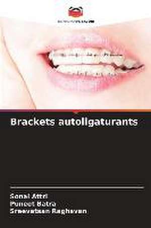 Brackets autoligaturants de Sonal Attri