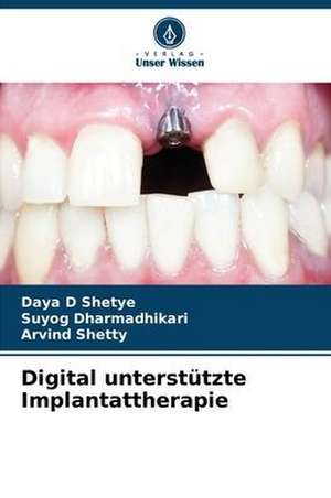 Digital unterstützte Implantattherapie de Daya D Shetye