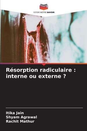 Résorption radiculaire : interne ou externe ? de Itika Jain