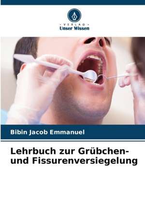 Lehrbuch zur Grübchen- und Fissurenversiegelung de Bibin Jacob Emmanuel