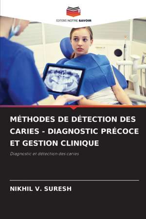 MÉTHODES DE DÉTECTION DES CARIES - DIAGNOSTIC PRÉCOCE ET GESTION CLINIQUE de Nikhil V. Suresh