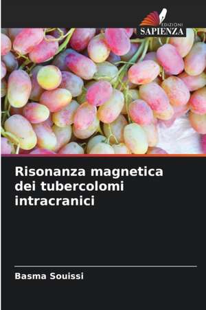 Risonanza magnetica dei tubercolomi intracranici de Basma Souissi