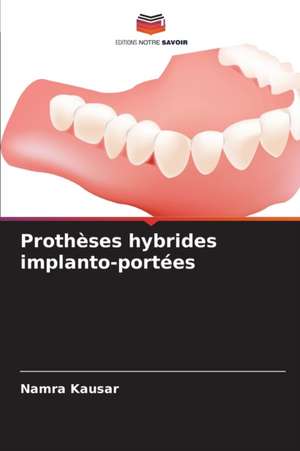 Prothèses hybrides implanto-portées de Namra Kausar