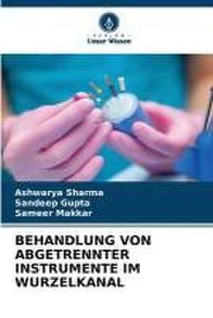 BEHANDLUNG VON ABGETRENNTER INSTRUMENTE IM WURZELKANAL de Ashwarya Sharma