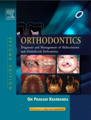 Orthodontics: Diagnosis of & Management of Malocclusion & Dentofacial Deformities de Om Prakash Kharbanda