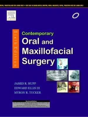 Contemporary Oral and Maxillofacial Surgery, 6e de James R. Hupp