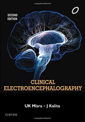 Clinical Electroencephalography de U.K. Misra