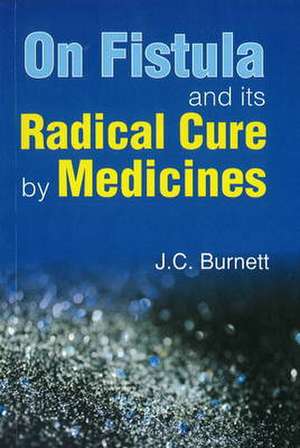 On Fistula & Its Radical Cure by Medicines de J.C-. Burnett