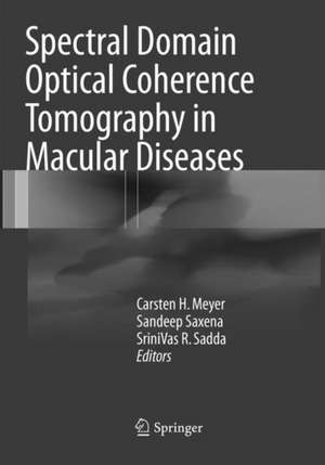 Spectral Domain Optical Coherence Tomography in Macular Diseases de Carsten H. Meyer