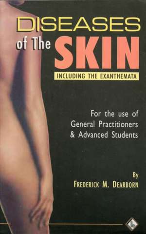 Diseases of the Skin de Frederick M. Dearborn